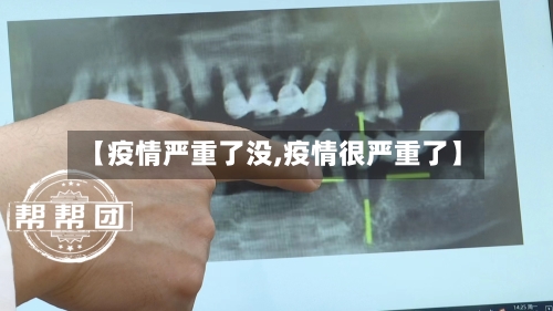 【疫情严重了没,疫情很严重了】-第1张图片