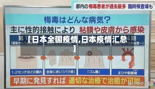 【日本全国疫情,日本疫情汇总】-第1张图片